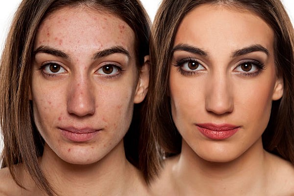 before after transformation results